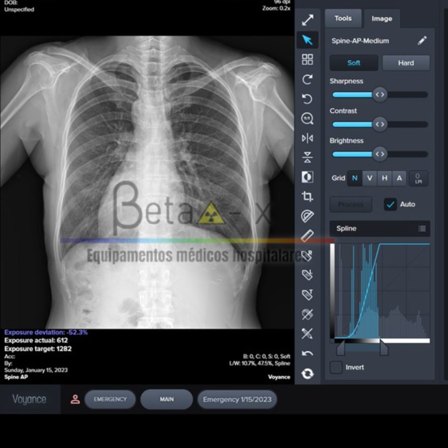 dd0fe28f4f9074a741ffe713a2fa2b6d